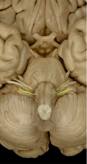 <ul><li><p>Sense of taste (Sensory)</p></li><li><p>Muscles that help swallow (motor) </p></li></ul><p></p>