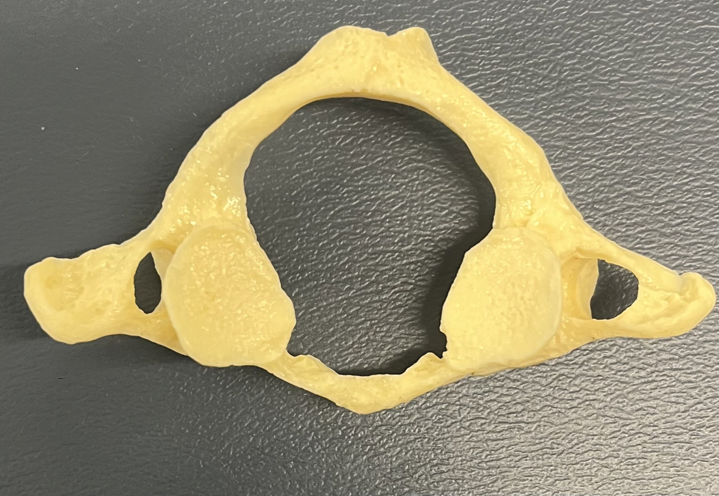 Which vertebrae is this?