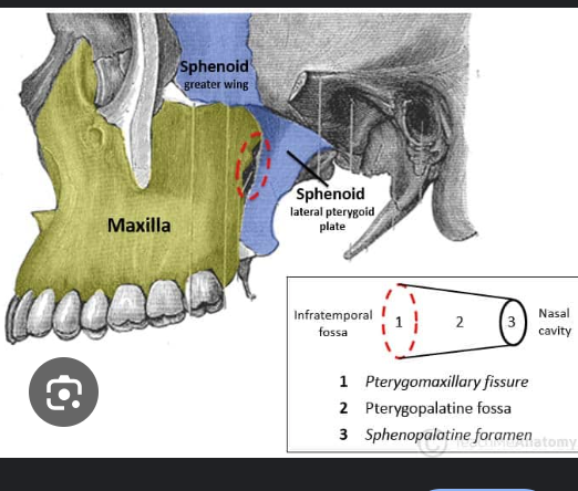 <p>what is this, its description and its appearance on images</p>