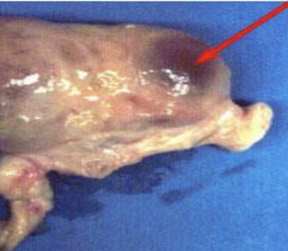 a small fluid filled sac in the ovary that contains an immature oocyte