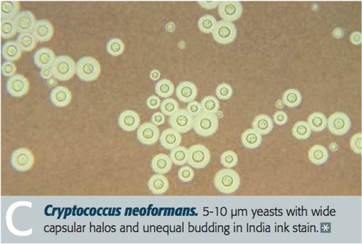 <p>An India ink stain showing cysts</p>