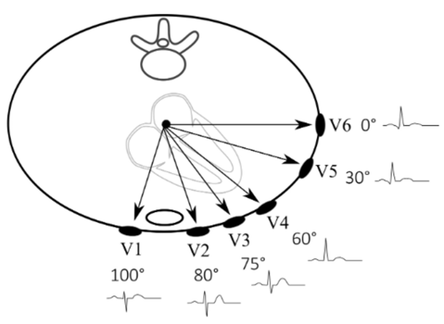 <p>I, AVL, V5, V6; circumflex</p>