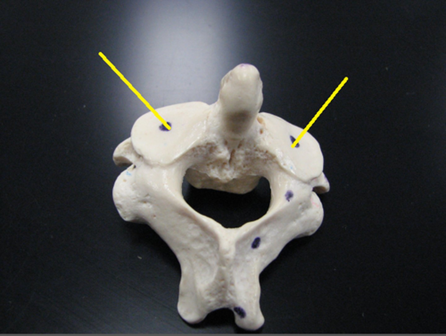 <p>articulates with the inferior articular facet of the first cervical vertebra (C1 or atlas)</p>