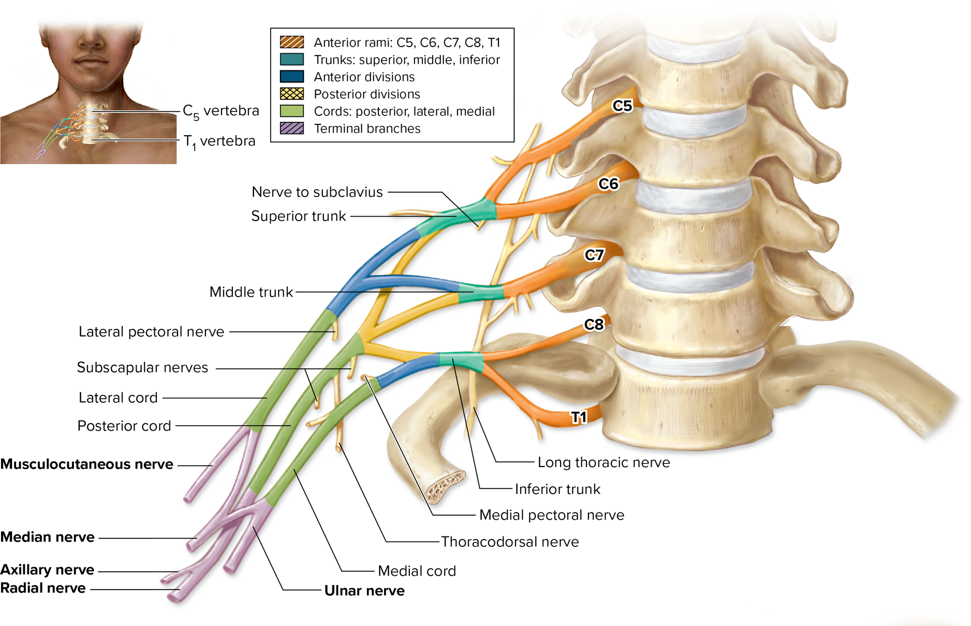 <p>Brachial Plexus (C5–T1)</p>
