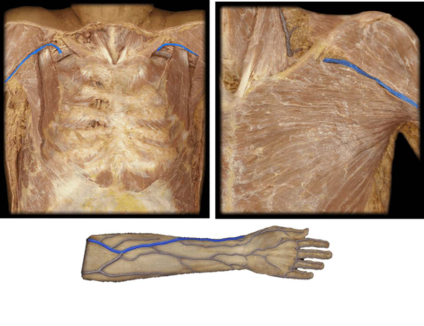 <p>Name these vessels.</p>