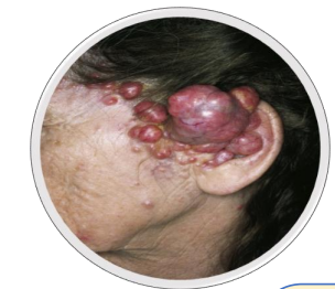 <p>What is this disorder</p>