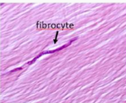 <p>What kind of tissue is this and where is it located?</p>