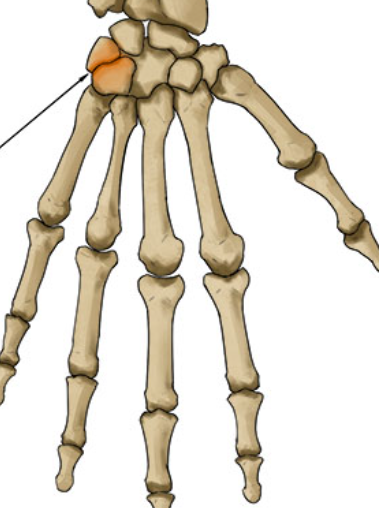 <p>Flat surfaces glide; ex: intercarpal joints.</p>