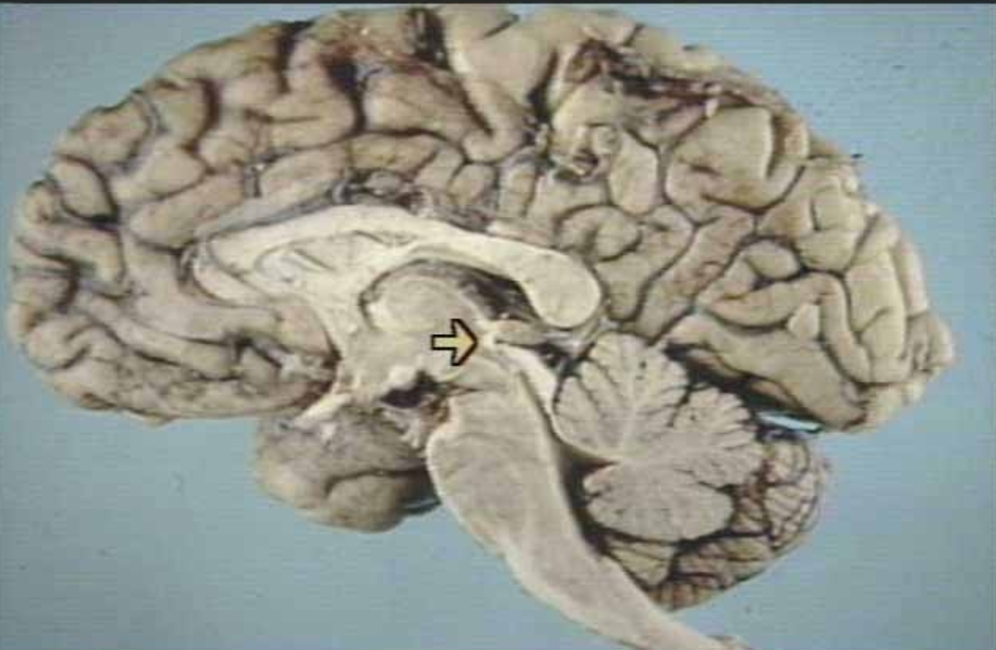 <p>What is the arrow pointing at?</p>