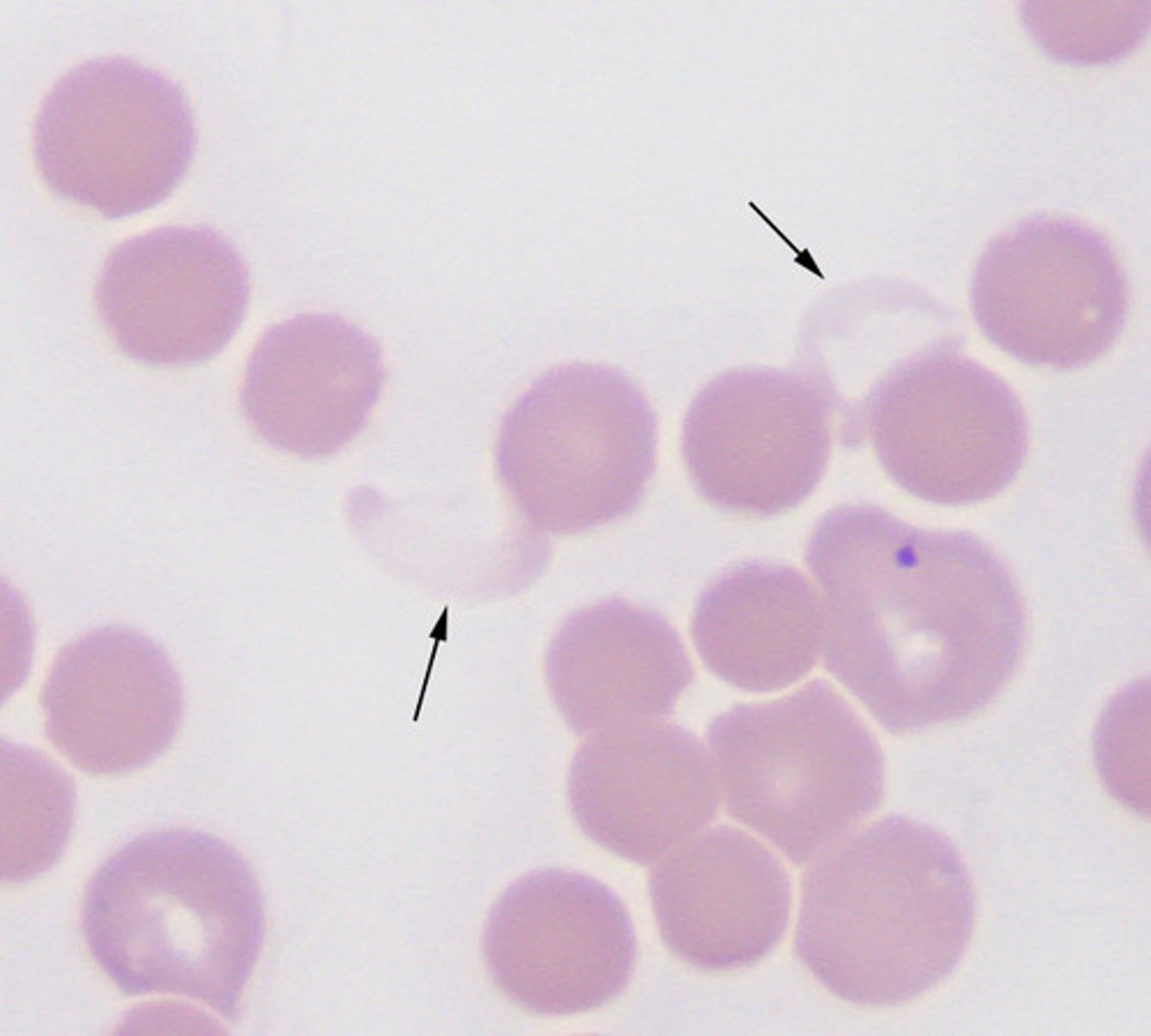 <p>Cells with No Nuclei within them</p><p>They can become calcified giving calcification on radiographs</p>