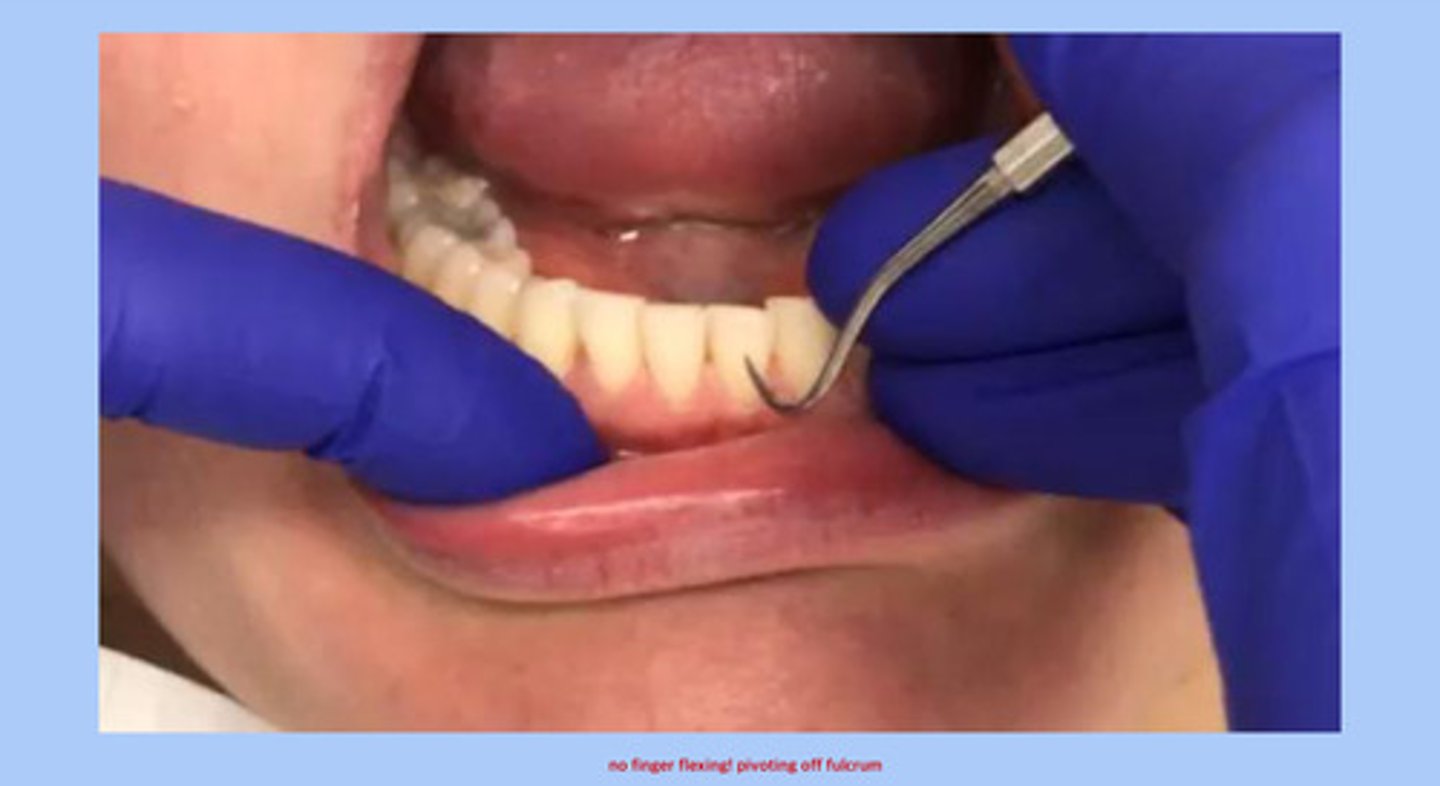 <p>note that you should not have finger flexing! you should pivot off the fulcrum with wrist-arm lateral movement</p>