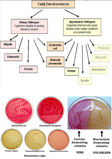 <p><strong>Enterobacteriaceae</strong> is a family of <strong>Gram-negative bacilli</strong>. What are some of the characteristics of this bacteria?</p>