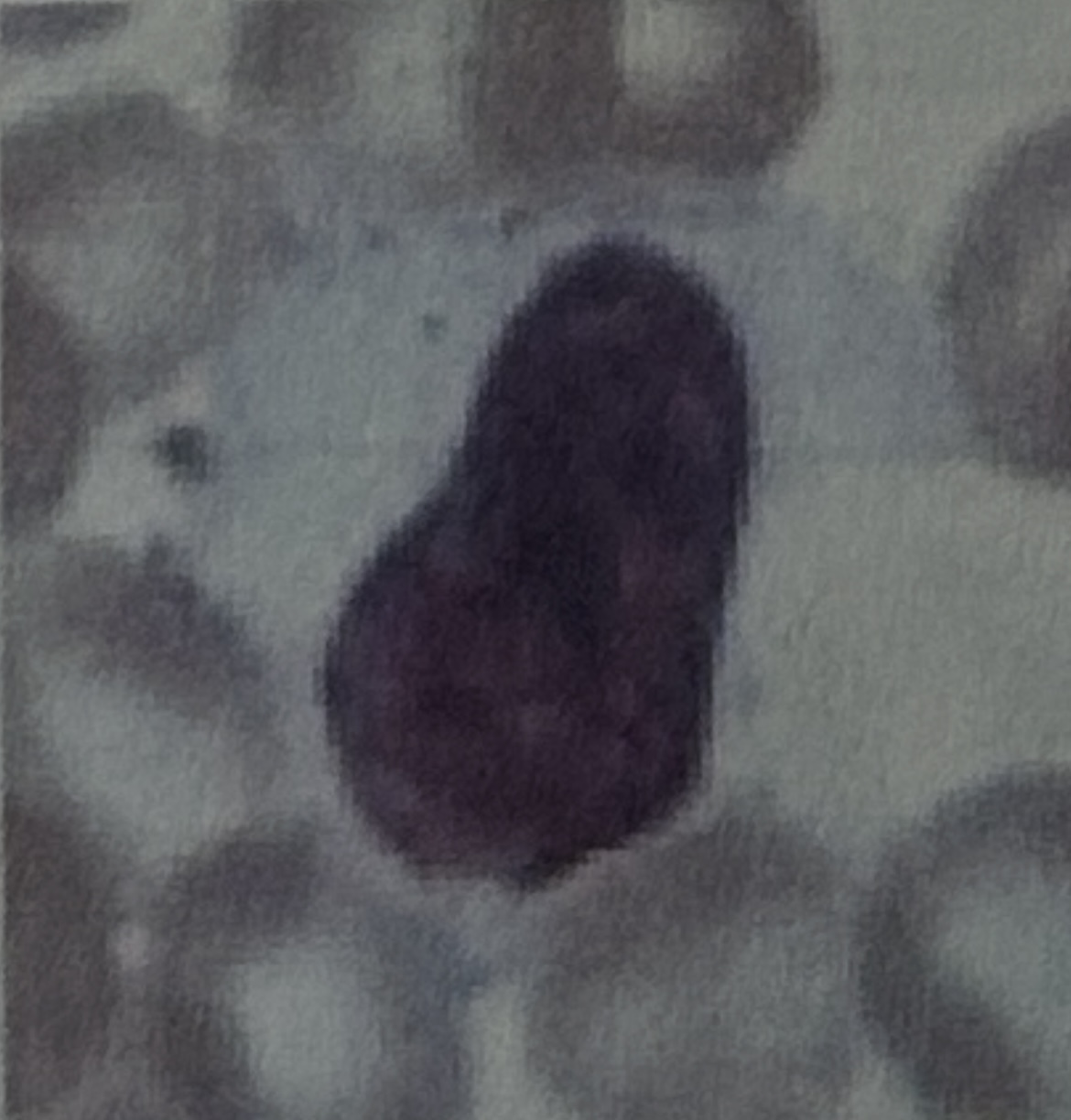 <p>WBC</p>