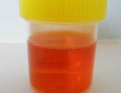 <p>Rifampin will make tears, saliva, and urine orange–red colour</p>
