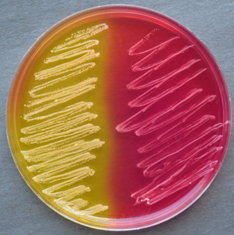 <p>Name this agar</p><p>Which side is positive</p><p>Which bacteria is positive</p><p>What is the indicator</p>