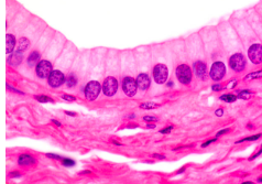 <ol><li><p>one</p></li><li><p>greater height than width</p></li><li><p>Fallopian tubes and digestive tract</p></li></ol><p></p>