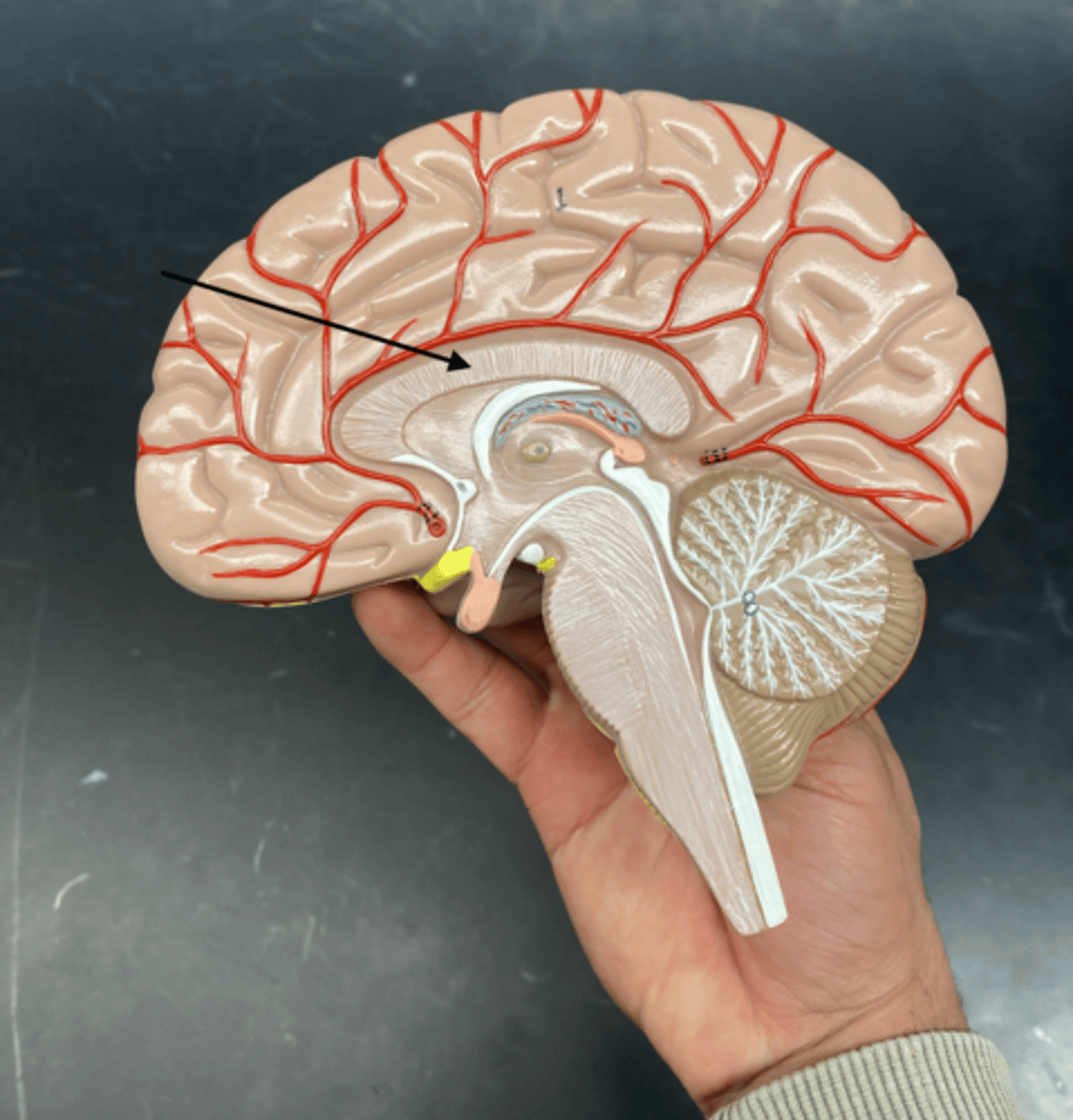 <p>is a thick band of nerve fibers that connects the left and right cerebral hemispheres, allowing them to communicate and coordinate activities.</p>