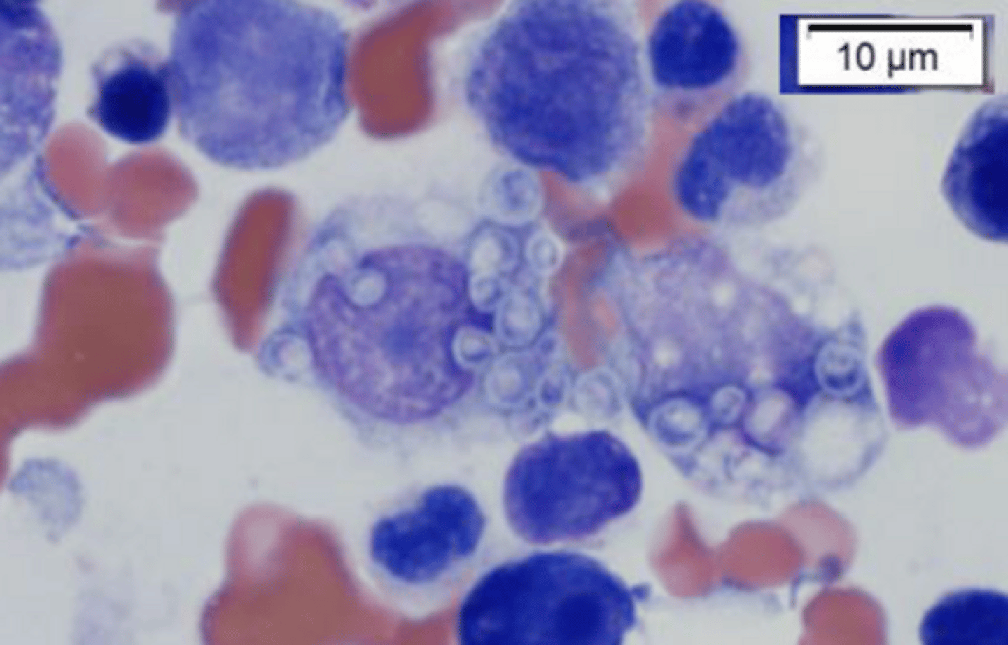 <p>Identify the organism and the size?</p>