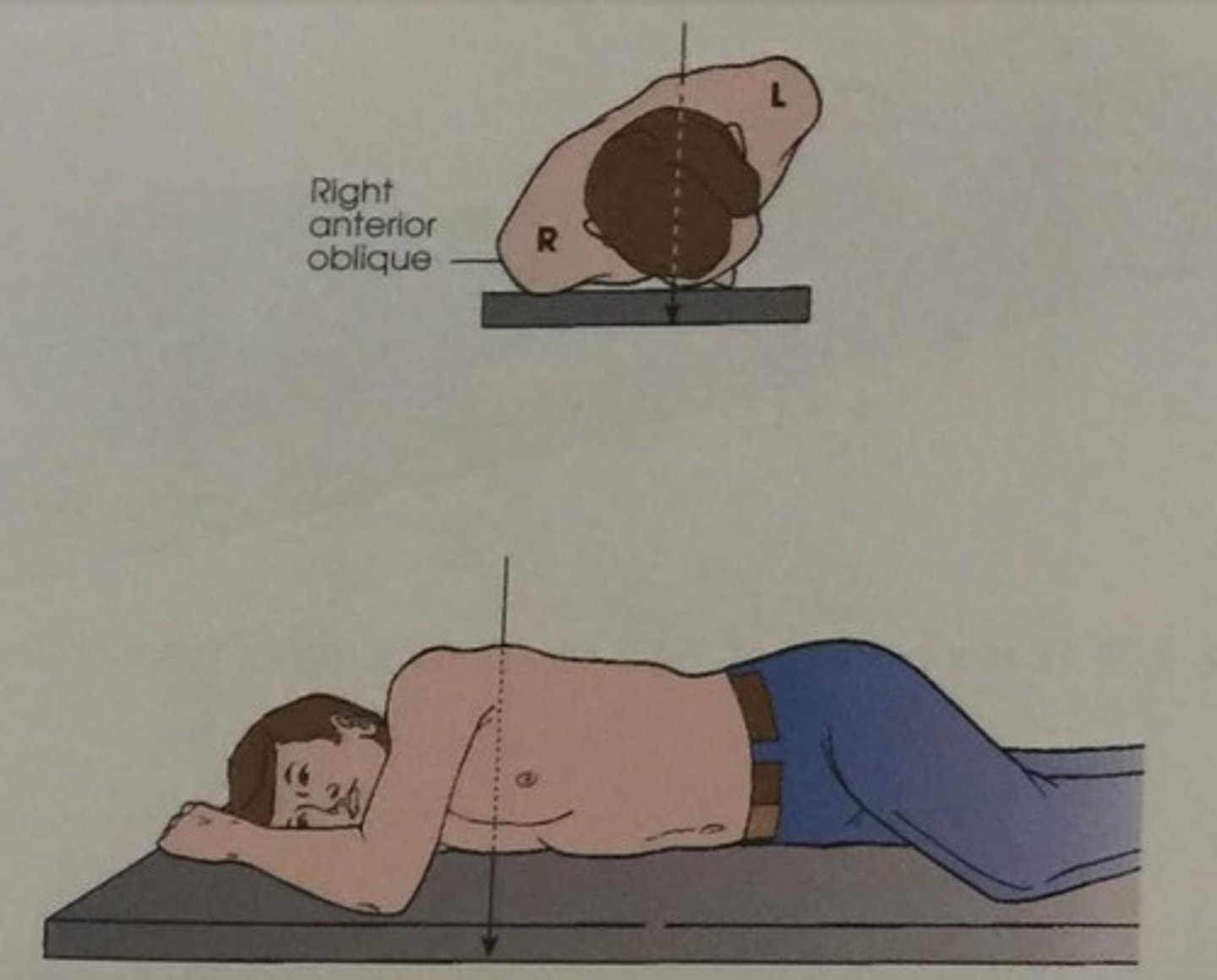 <p>Right Anterior Oblique</p>