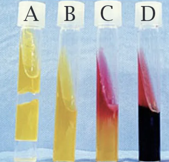 <p>Is this a positive or negative&nbsp;Kliger’s Iron Agar test?</p>