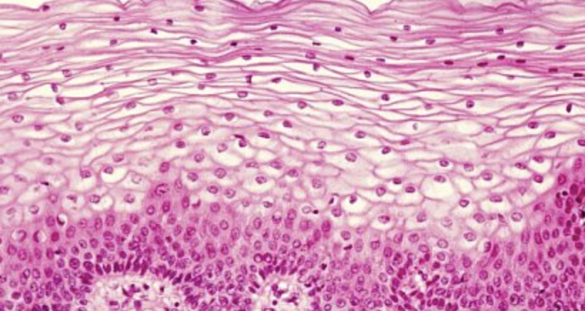 <p><span>- </span><strong><span>multi-layered </span></strong><span>tissue composed of</span><strong><span> basal cuboidal & flat, scale-like surface</span></strong><span> (squamous) cells</span></p><p><strong><span>function</span></strong><span> → </span><strong><span>protective barrier</span></strong><span> against </span><strong><span>physical abrasion</span></strong><span> </span></p>