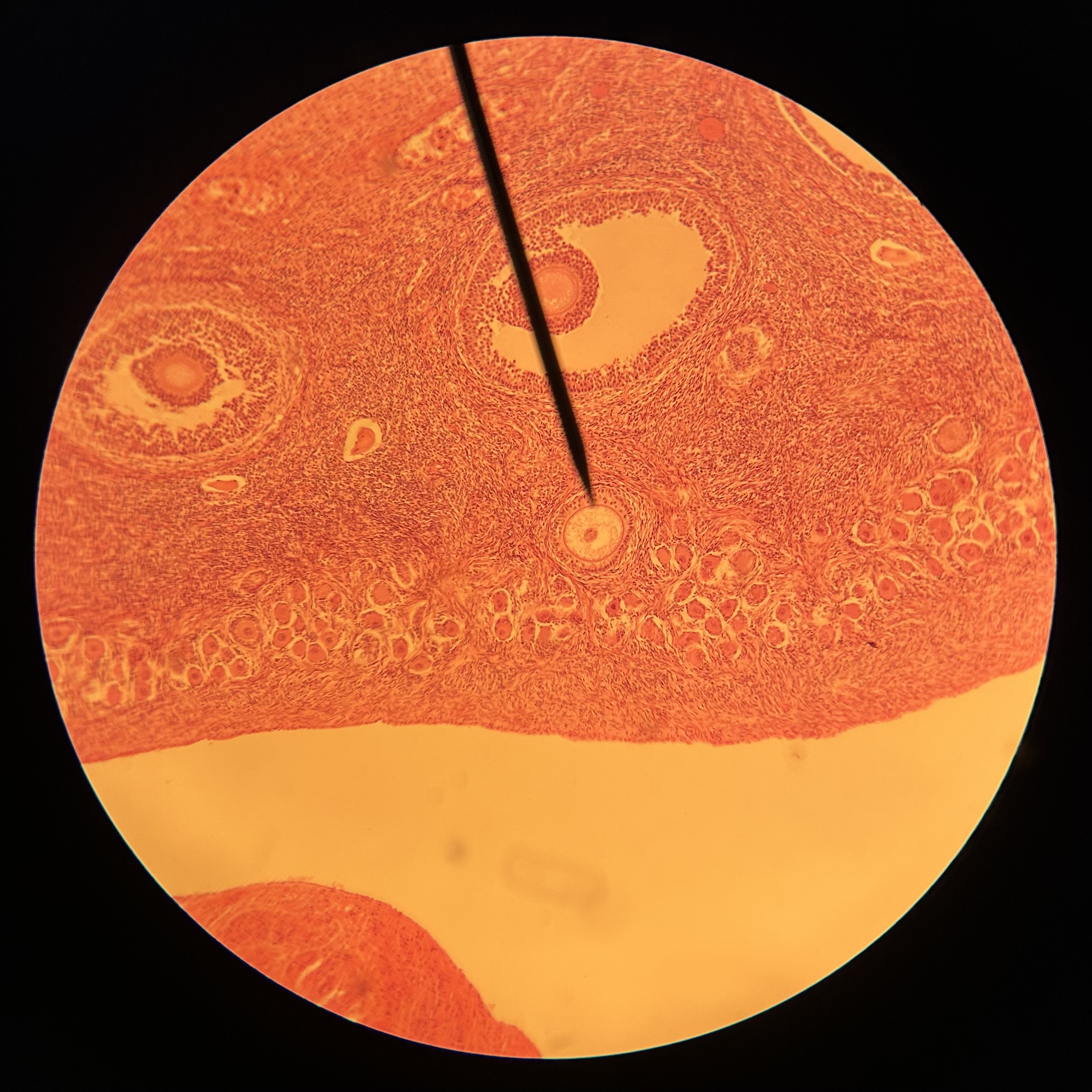 <p>What structure is shown (at pointer)?</p>