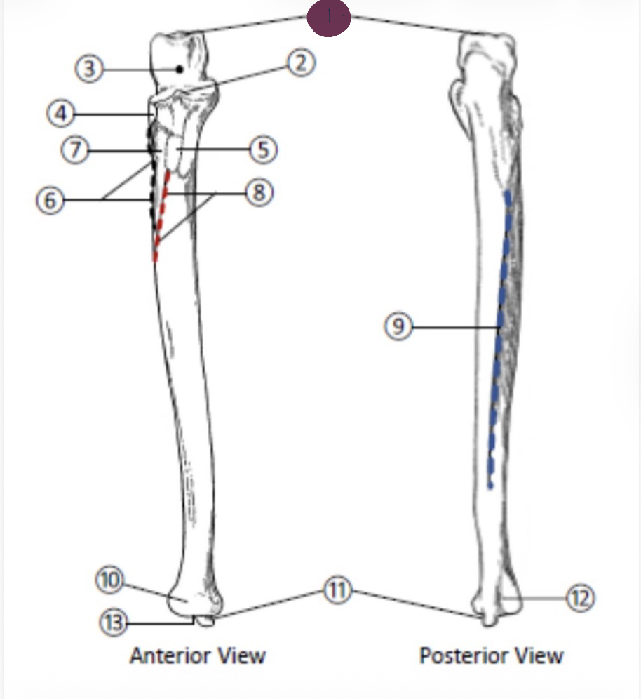 <p>On the Proximal end of the Ulna, which part is highlighted (1)?</p>