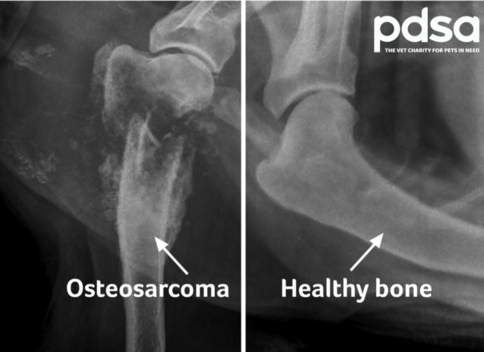 <p><strong>osteosarcoma.</strong></p><ul><li><p>we can see the appearance of “sunburst”, typical for osteosarcoma. </p></li></ul><p></p>