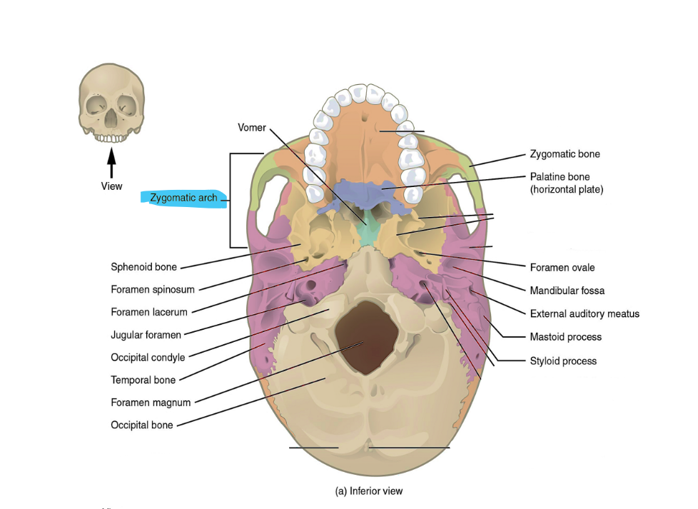 <p>zygomatic arch</p>