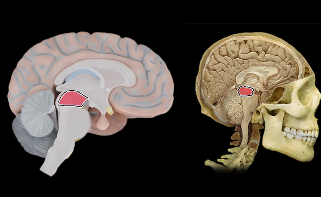 term image