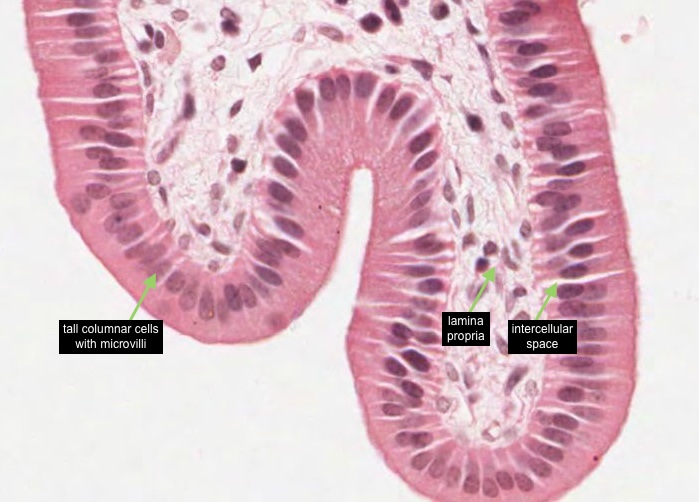 Gallbladder epithelium