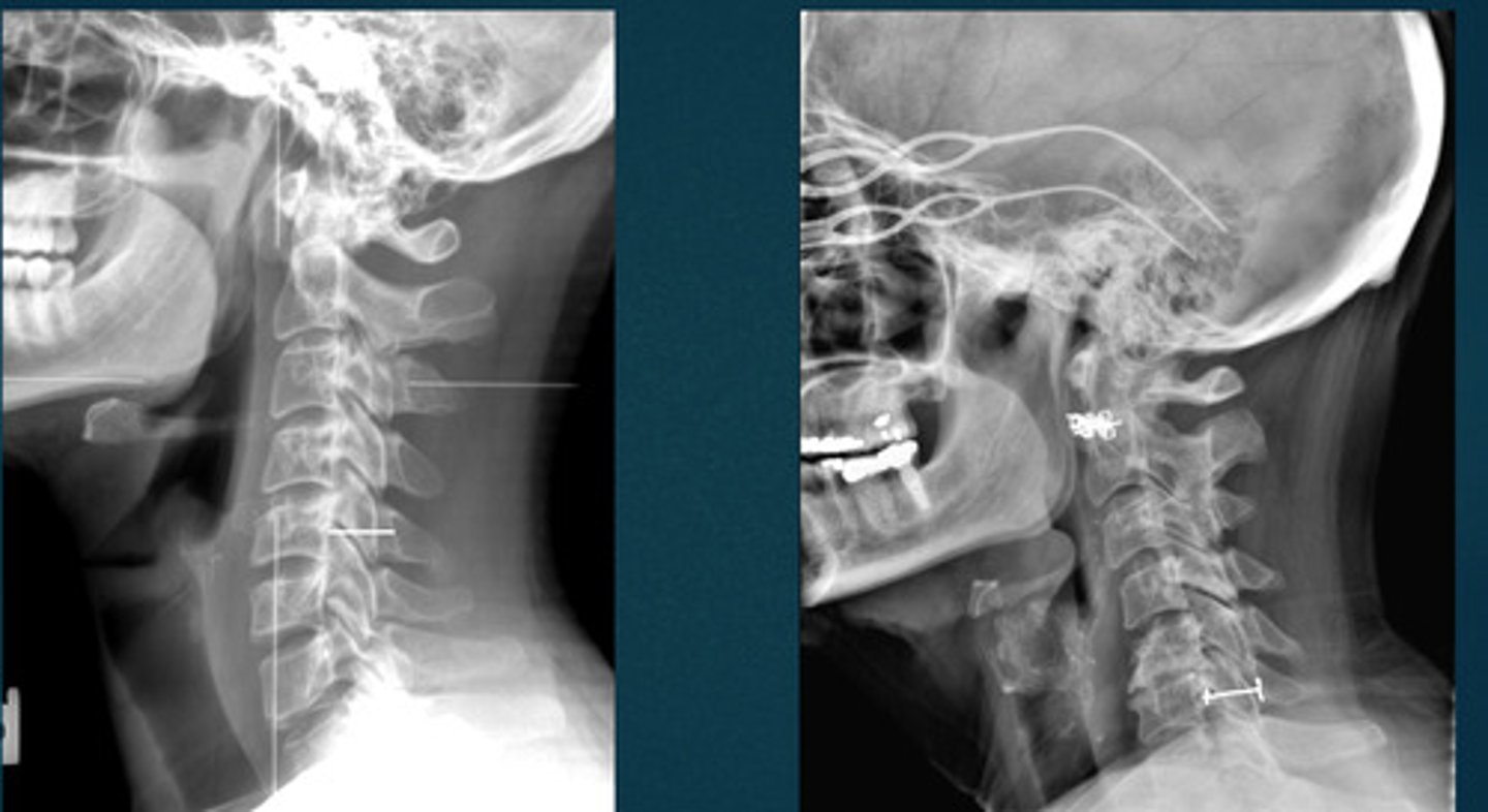 <p>What line of mensuration is this?</p>