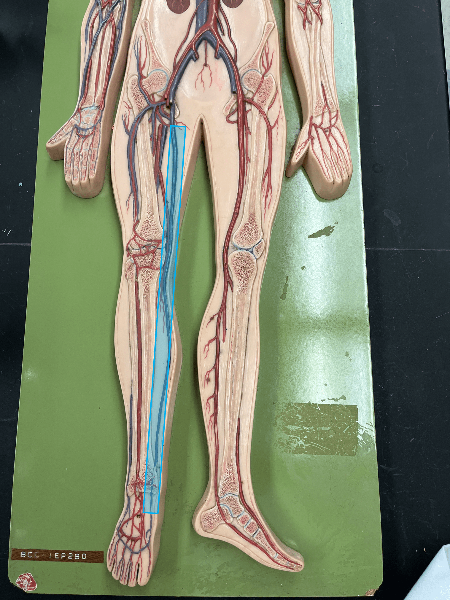 <p>• A vein of the lower limb.</p>
<p>• Drains the medial lower leg and thigh.</p>
<p>• Empties into the femoral vein.</p>
<p>• Longest vein of the body.</p>