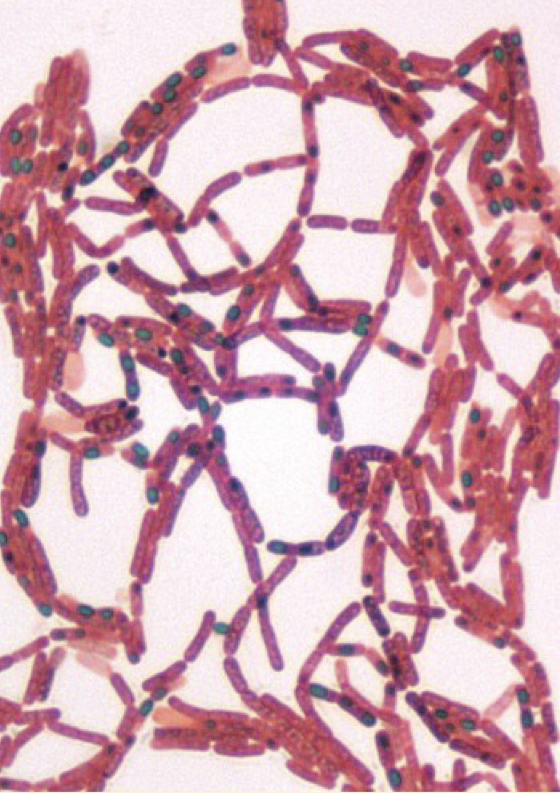 <p></p><ul><li><p>Large block shaped angular, nonmotile rods</p></li><li><p>Central spores develop under all conditions except in the living body</p></li><li><p>Cause of anthrax</p></li></ul>