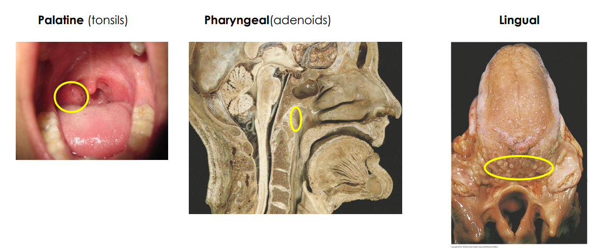 <p>DIAGRAM ON SLIDE 21</p>