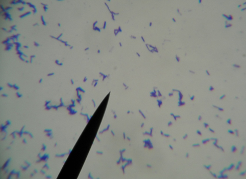 <p>What kind of stain, + or -, what kind of bacteria?</p>