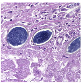 <p>Figure D: Eggs of _________, stained with H&amp;E. at 400x magnification.</p>