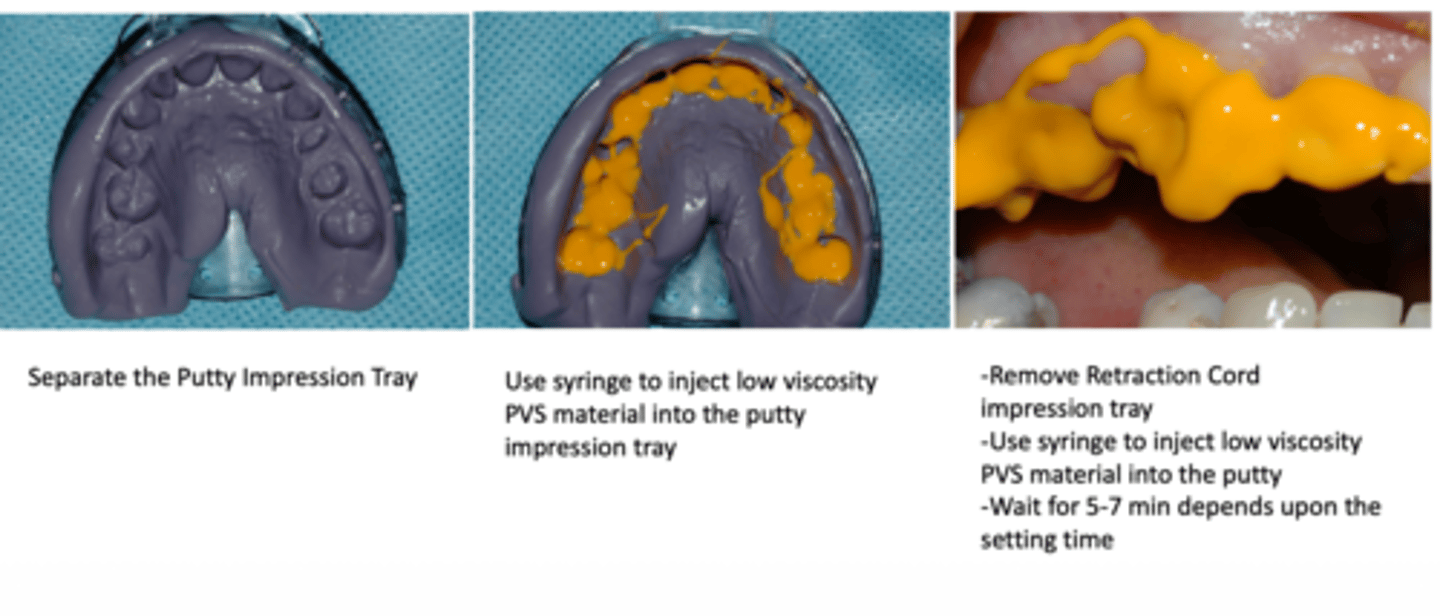 <p>What technique?</p>