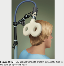 <p>temporarily disrupts the normal functioning of neurons.</p><ul><li><p><span style="color: green">Example</span>: When researchers applied TMS to the MT cortex, participants had difficulty determining the direction in which a random pattern of dots was moving.</p></li><li><p>Although the effect was temporary, these participants experienced a form of akinetopsia much like patient L.M.</p></li></ul><p></p>