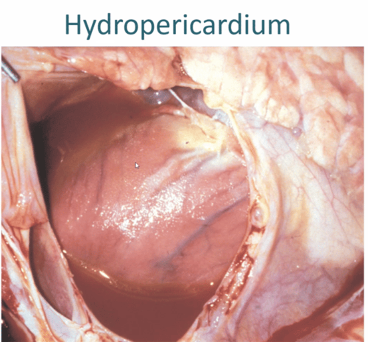 <p>1. Generalised oedema</p><p>2. Congestive Heart failure </p><p>3. Pulmonary Hypertension</p><p>4. Hypoproteinemia</p><p>5. Systemic Vascular Injury</p>