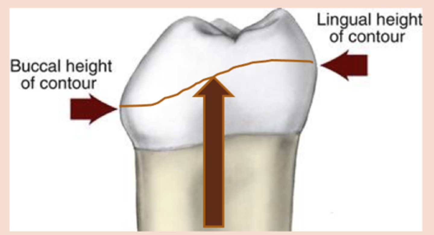 <p>height of contour marked around the tooth</p>