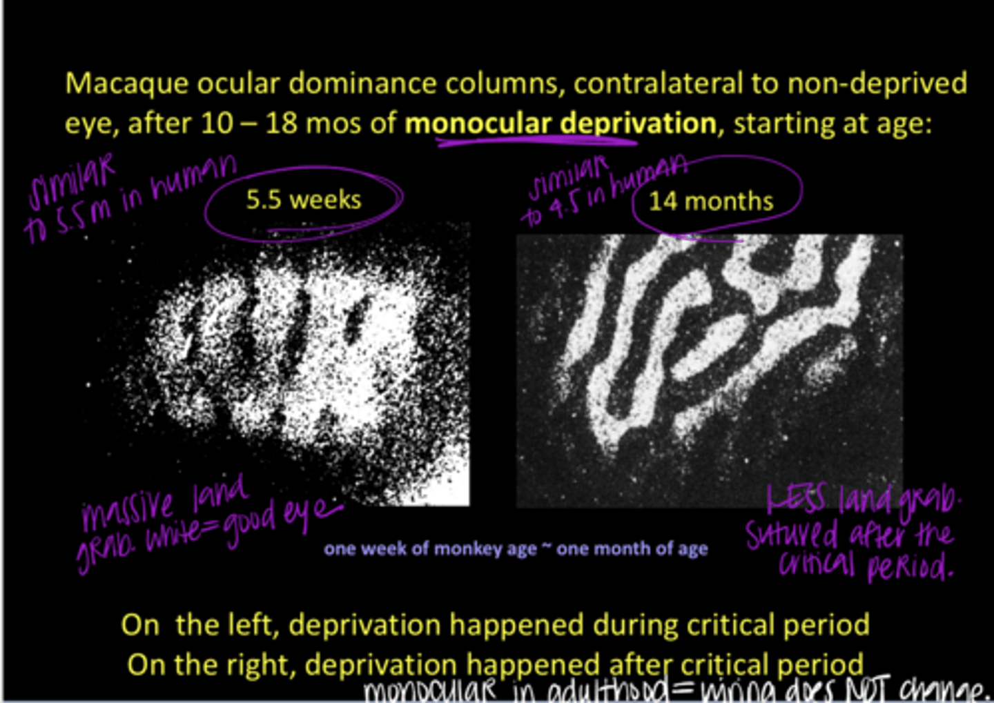 <p>Deprivation During Critical Period v Deprivation After the Critical Period (Pic)</p><p>**deprivation during CP = massive land grab by the good eye; major deprivation of bad eye</p><p>After CP = less land grab; wiring not as changed</p>