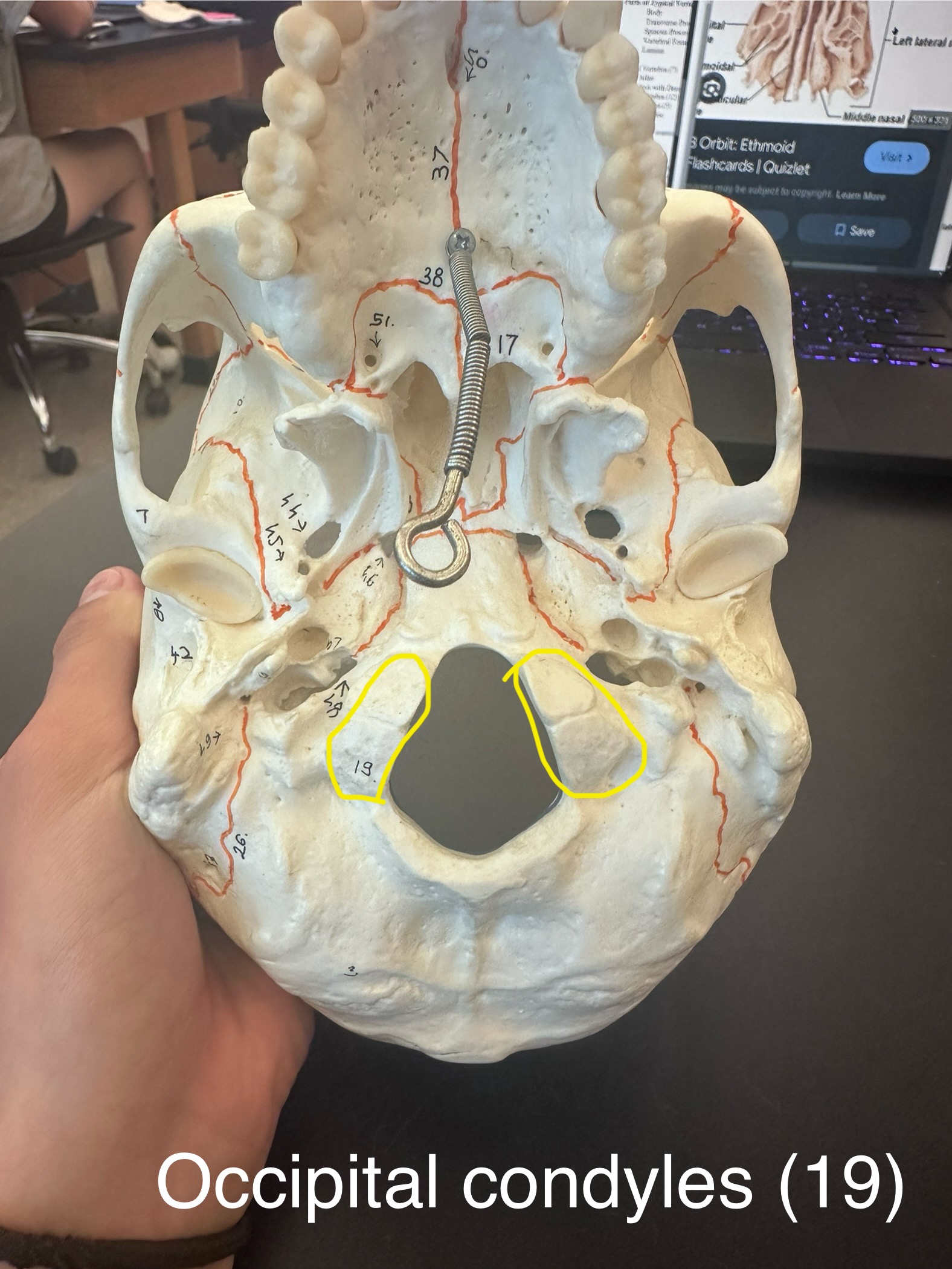 <p>Occipital Condyles</p>