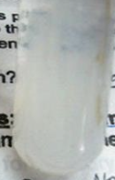 <p>What are the reagents added?</p>