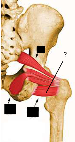 <p>Nom et caractéristiques de cette structure ?</p>