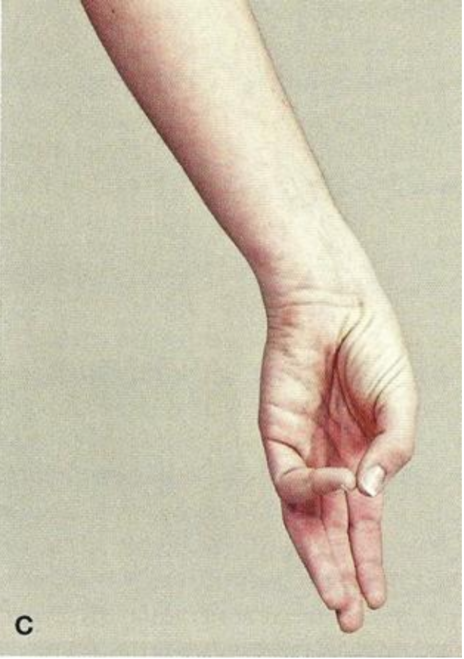 <p><span>Mouvement curvilinéaire (pouce aux autres doigts)</span></p>