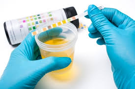 <p><strong>A patient in a hospital is frustrated at the inconvenience of having to collect his urine for an entire day and night as part of an ordered 24-hour urine collection test. He asks the nurse why the test is necessary since he provided a single urine sample 2 days ago. How could the nurse best respond to the patient's question?</strong></p><p>A) “A single urine sample lets your care team determine if there are bacteria in your</p><p>urine, but other tests of urine chemistry need a longer-term view.”</p><p>B) “Current lab tests aren't able to detect the small quantities of most substances</p><p>contained in a single urine sample.</p><p>C) “Only a longer-term test is able to show whether your kidneys are letting sugar</p><p>spill out into your urine.”</p><p>D) “Often why an abnormal substance shows up in urine test, a 24-hour urine collection is needed to determine exactly how much it is present in your urine.”</p>