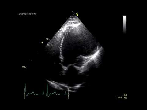 <p>What is seen in the 2D image?</p>