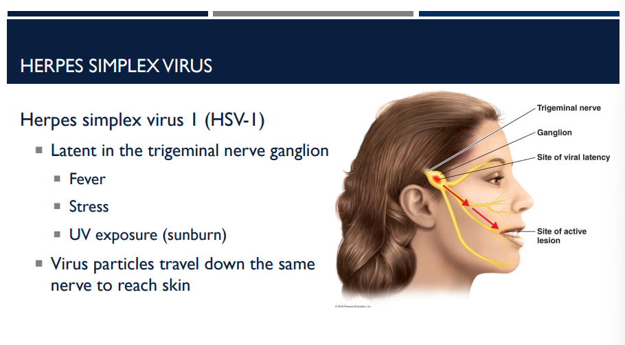 <ul><li><p>Polyhedral, enveloped virus</p></li><li><p>Causes cold sores and herpetic keratitis (infection of the cornea)</p></li><li><p>~90% of the population is infected, but most infections are subclinical</p></li><li><p>Treatments, but no cure</p><ul><li><p>Acyclovir (prescription) – nucleoside analog</p></li><li><p>Docosanol (OTC) – prevents viral fusion</p></li><li><p>Hydrocolloid patch – absorbs fluid and promotes healing</p></li></ul></li><li><p>Latent in the trigeminal nerve ganglion</p><ul><li><p>Fever</p></li><li><p>Stress</p></li><li><p>UV Exposure (sunburn)</p></li></ul></li><li><p>Virus particles travel down the same nerve to reach skin </p></li></ul><p></p>