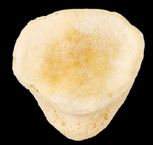 <p>Name this bone.</p><p>(Posterior view, right side).</p>
